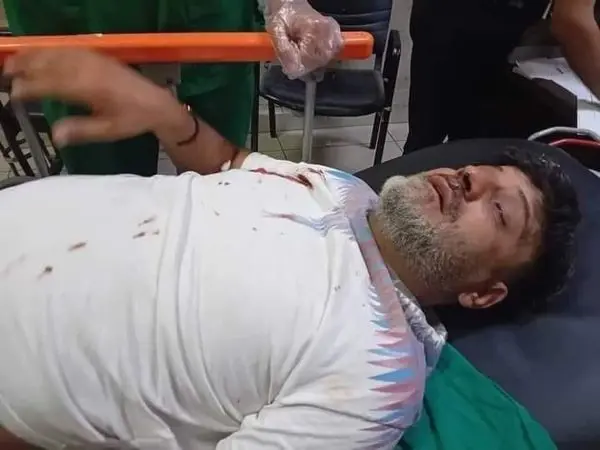 المطرب السوري بهاء اليوسف عقب الحادث