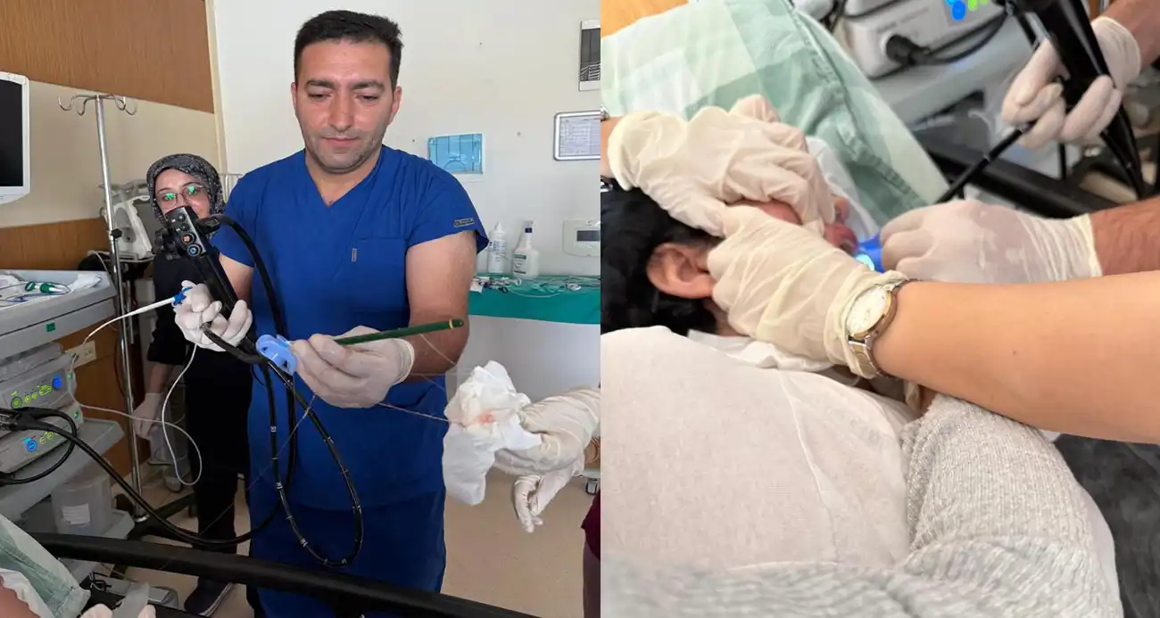 استخراج قلمين من معدة شابة تركية