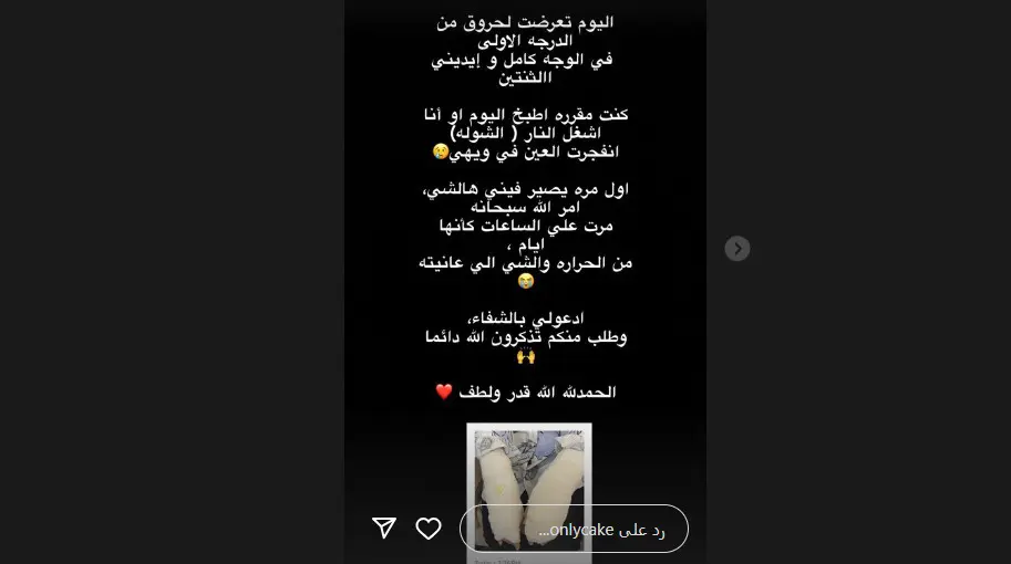 منشور الشيف الكويتية عن تفاصيل حادثة الحرق