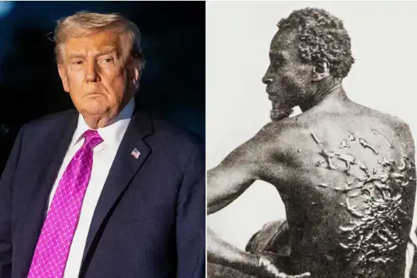 ترامب وصورة الظهر المجروح