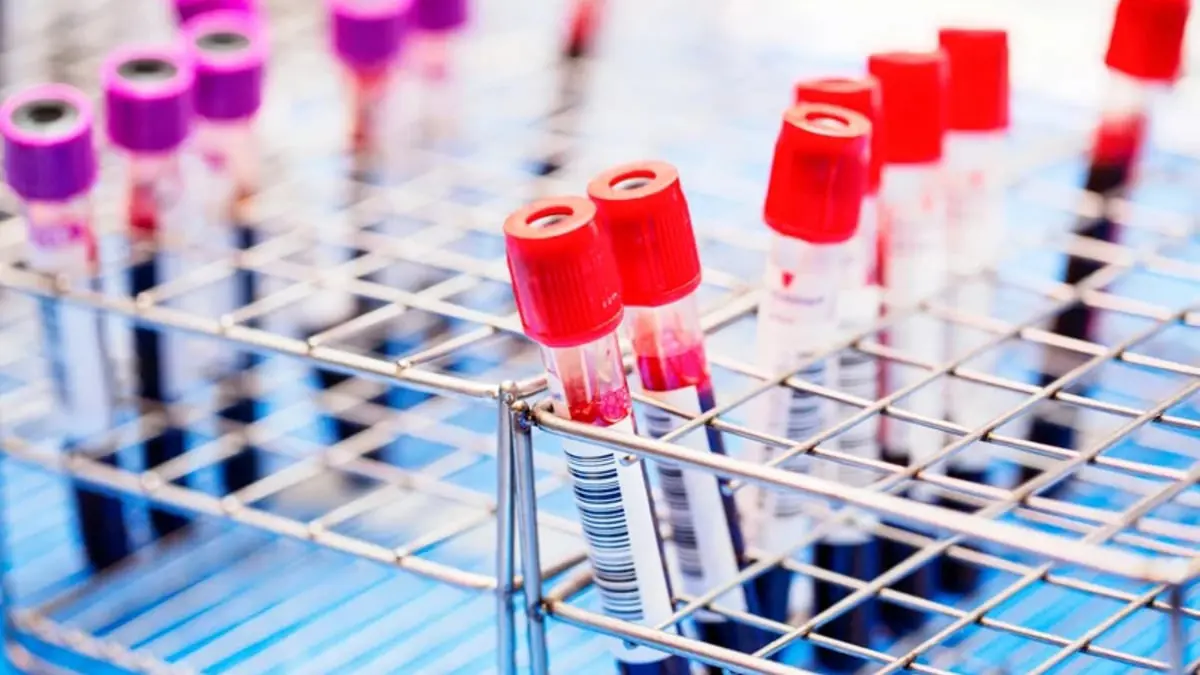 اختبار دم بسيط يستطيع اكتشاف سرطان القولون والمستقيم 