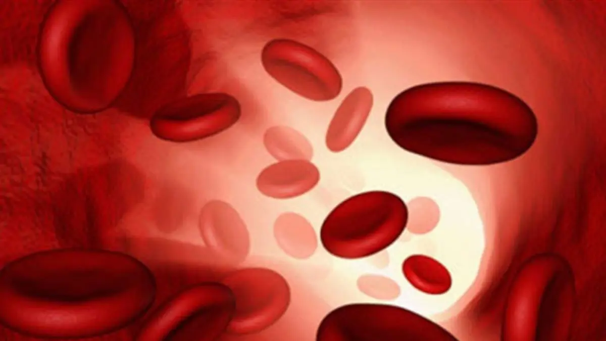 دراسة: نقص الحديد في الدم قد يسبب جلطة دماغية