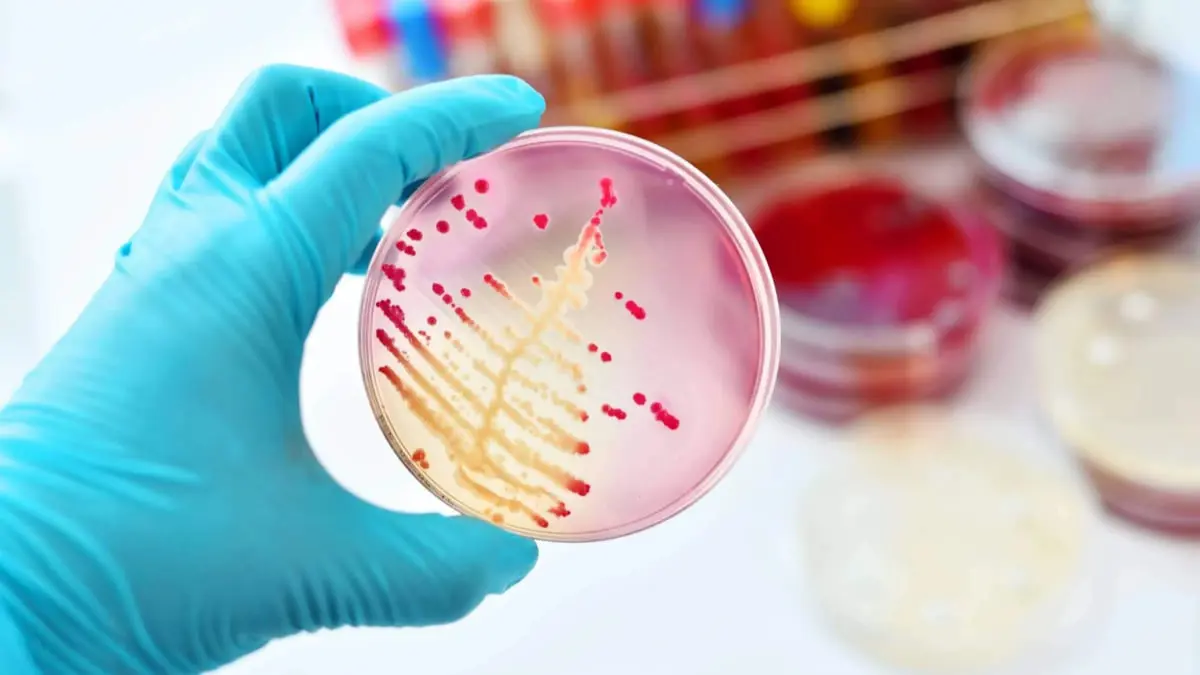 اكتشاف بكتيريا فعالة ضد سلالتين مقاومتين للأدوية