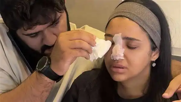 إصابة كنزي مدبولي بسبب حقنة فيلر