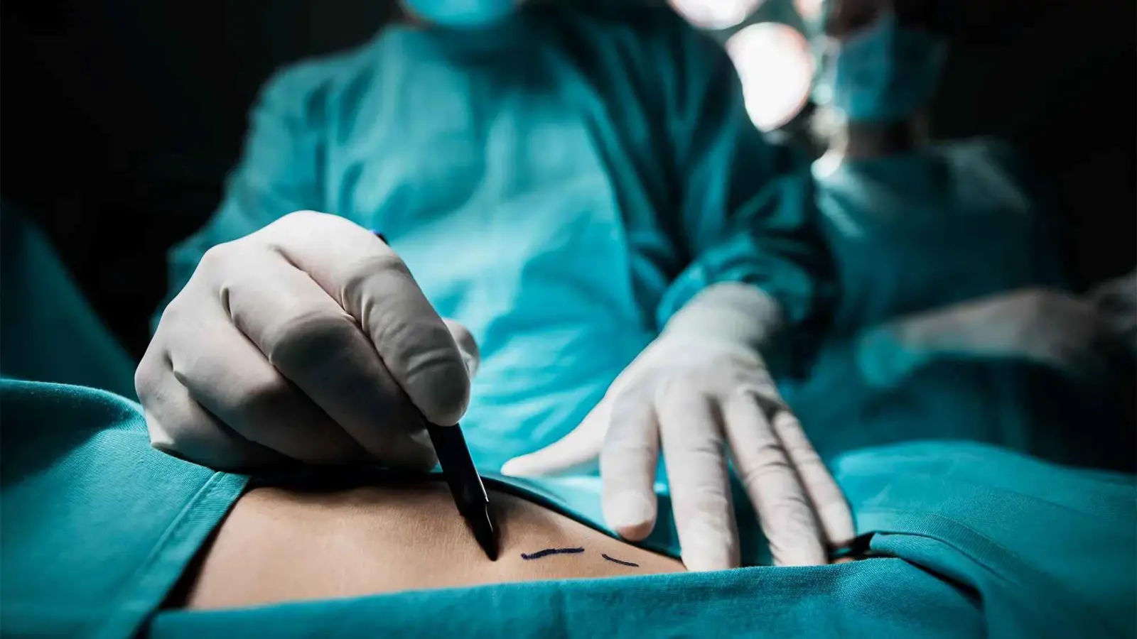 وفاة جديدة وشكاوى متصاعدة.. مدينة عراقية تحظر عمليات شفط الدهون