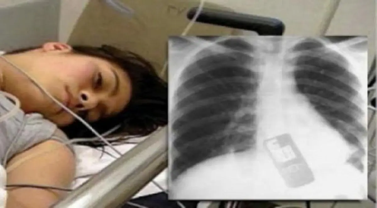 برازيلية تبتلع هاتفها لمنع صديقها من اكتشاف خيانتها