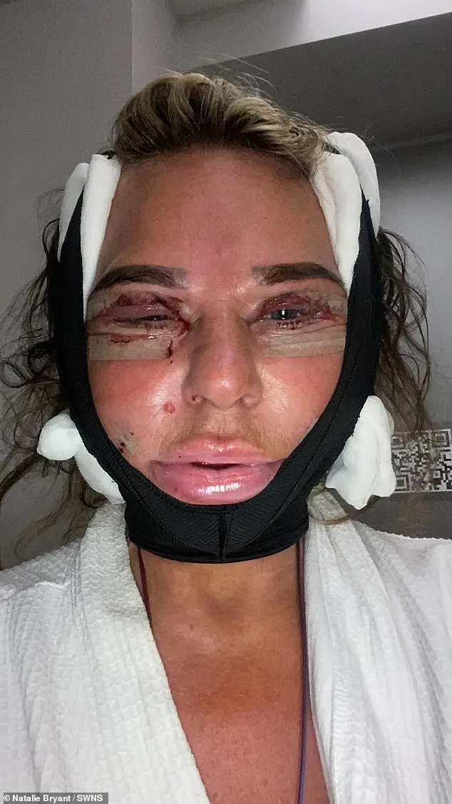 ناتالي براينت بعد عملية التجميل في تركيا