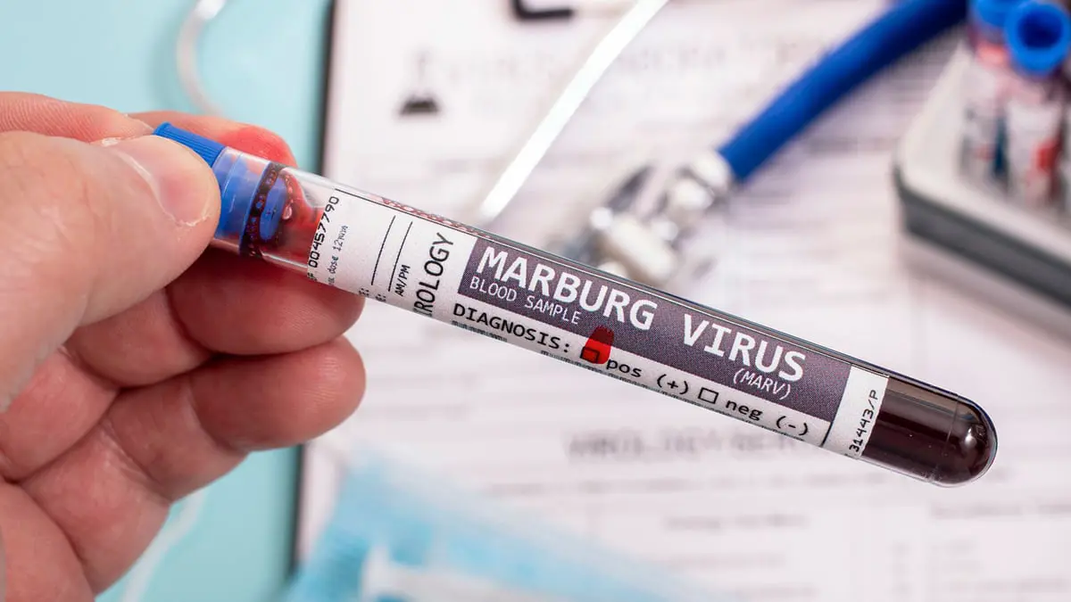 إسبانيا: حالة الاشتباه بفيروس ماربورغ غير مصابة بالمرض