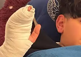 معلم يكسر ذراع طالب