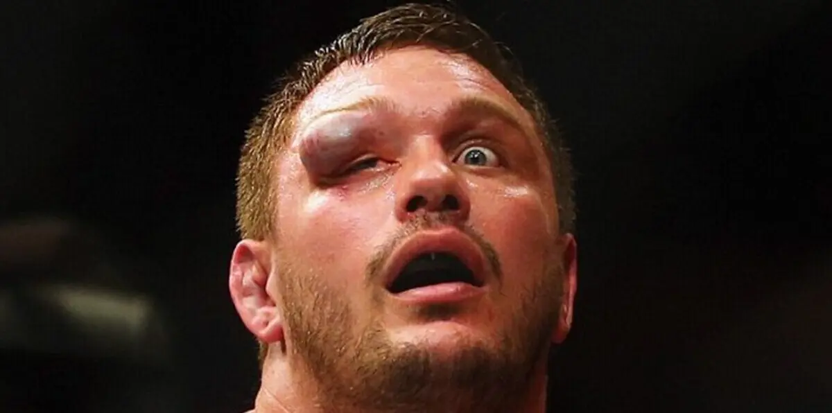 شراسة غير مسبوقة في منافسات UFC (صور)