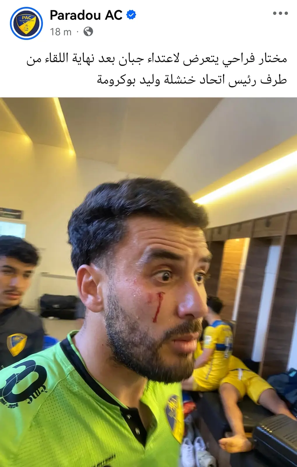 حارس مرمى بارادو مختار فرادو 