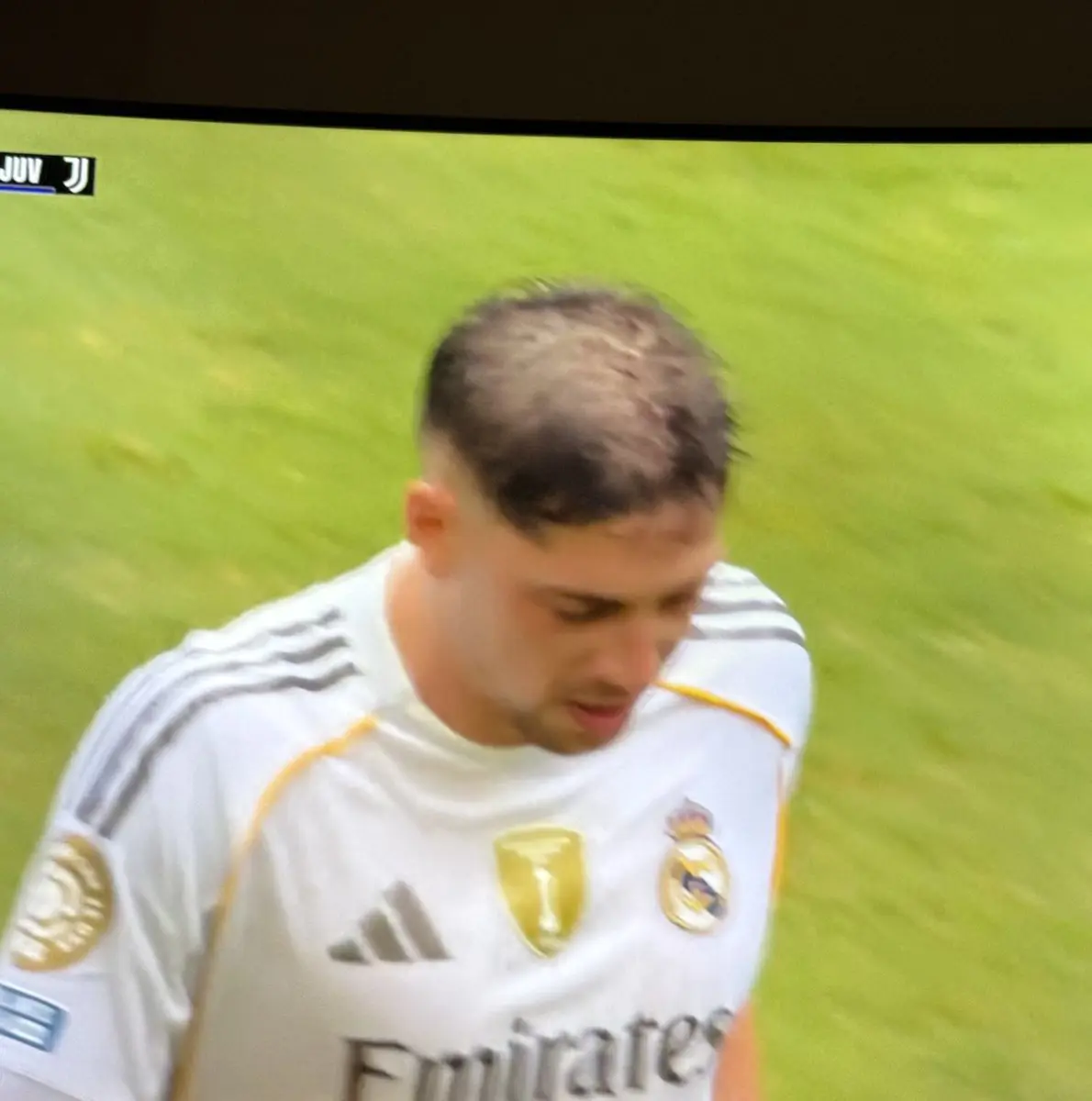 صورة منتشرة للاعب فالفيردي وشعره يتساقط