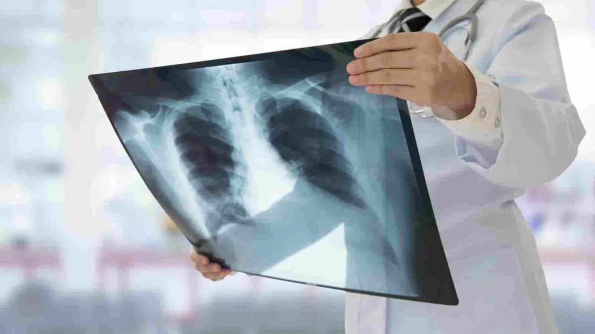 10 أطعمة مميزة للحفاظ على صحة الرئتين