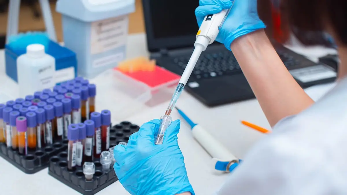 باحثون: اختبار تعفن الدم يساعد على كشف السرطانات العدوانية في المراحل الأولى