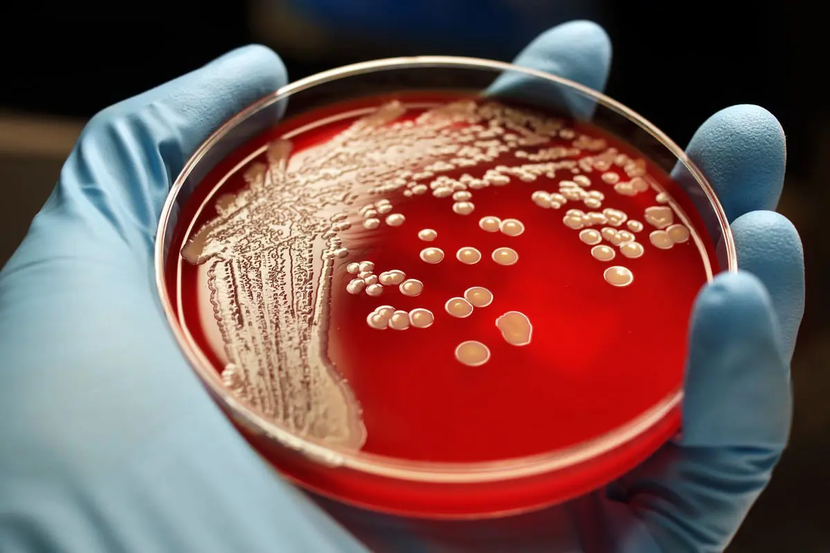 بكتيريا قاتلة تُظهر انجذابًا لدم الإنسان