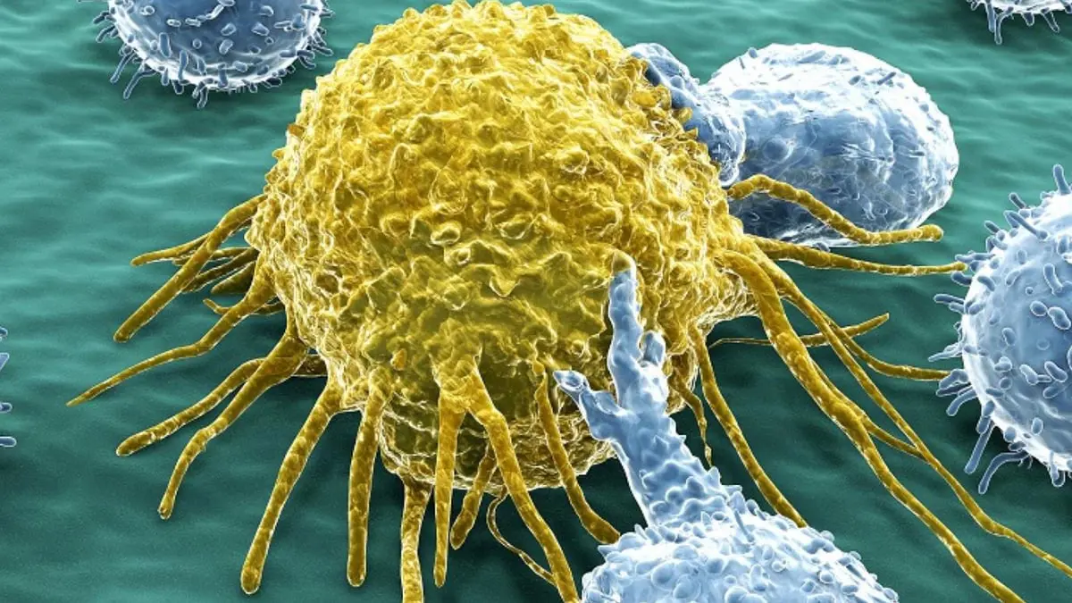 "الجزيئات الدقيقة" علاج جديد قادر على تدمير الخلايا السرطانية