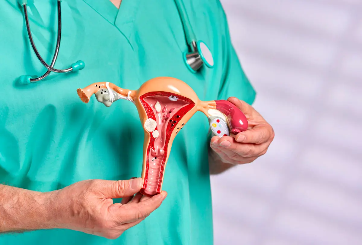 إزالة المبيض عند استئصال الرحم قد تُسبب أمراضًا خطيرةً