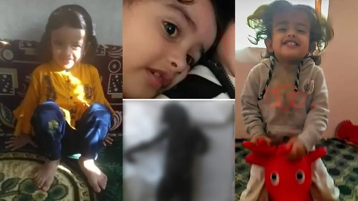 صورة طفلة متفحمة جراء قصف حوثي تصدم اليمنيين