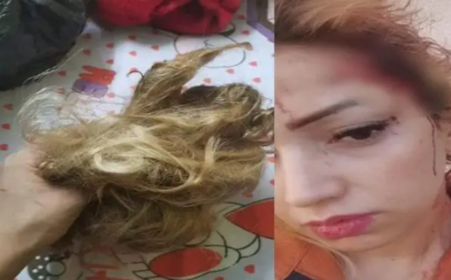 الزوجة بعد ضربها 