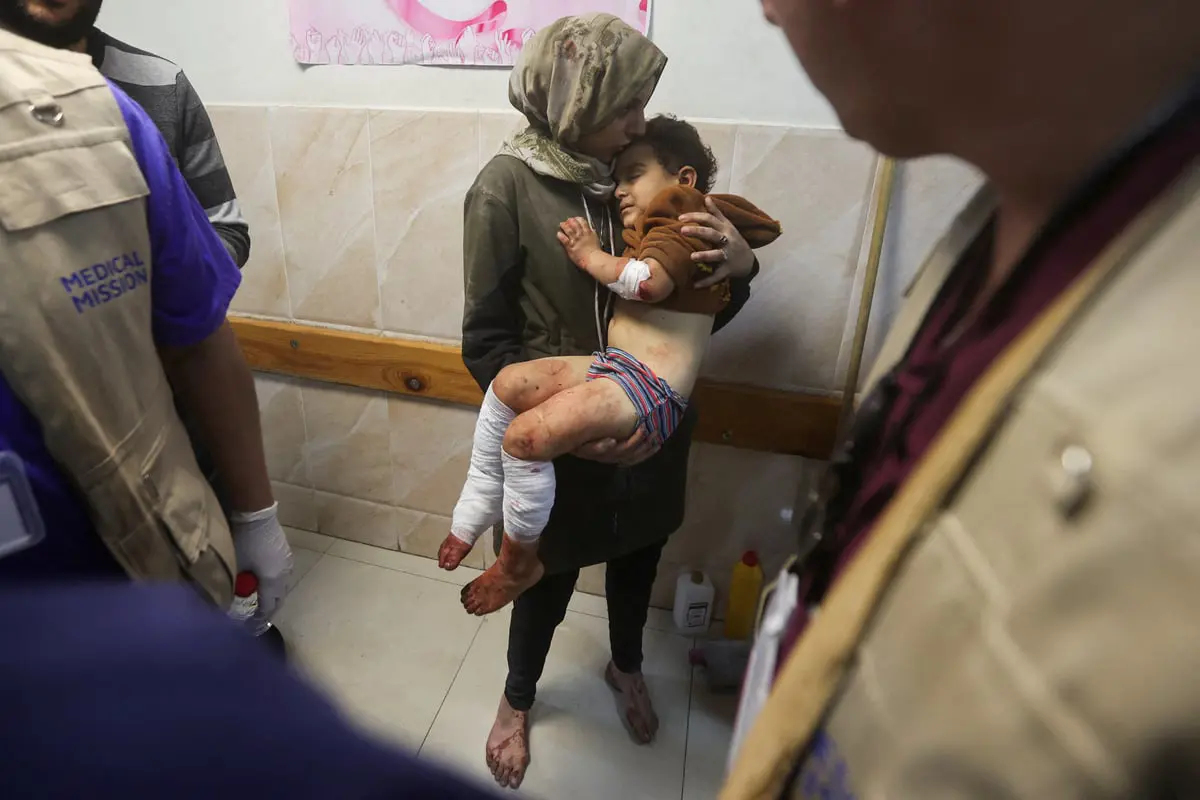 فرنسا تستقبل 7 أطفال لعلاجهم من إصابات جراء حرب غزة