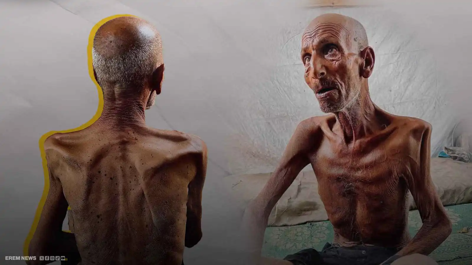 فقد 40 كغم من وزنه.. مشهد صادم لمؤذن غزي يصارع الموت جوعاً (فيديو إرم)
