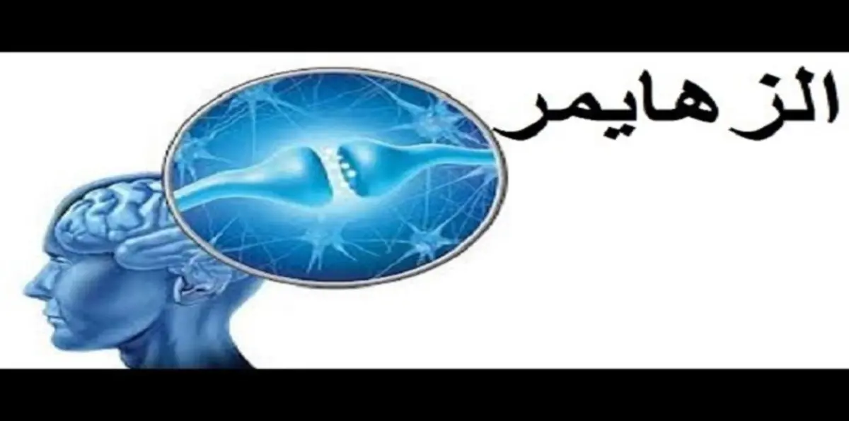35 ألف تونسي يعانون من مرض "الزهايمر"