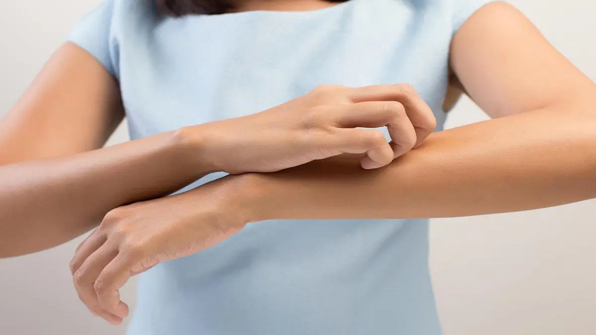 5 أمراض جلدية مرتبطة بفيروس كورونا.. تعرف عليها