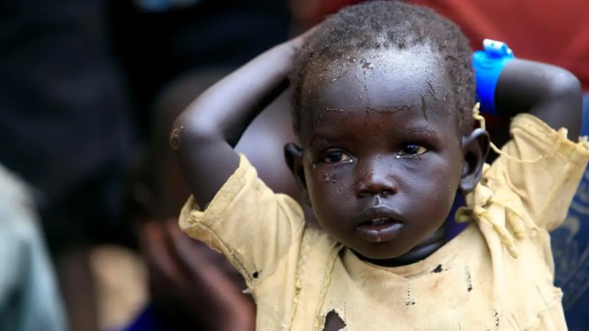 الأمم المتحدة تؤكد وفاة 1200 طفل في السودان وتحذر من ارتفاع العدد