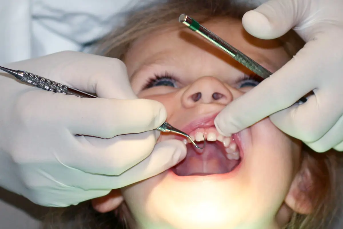 حل آمن و"غير مكلف" لمكافحة تسوس أسنان الأطفال