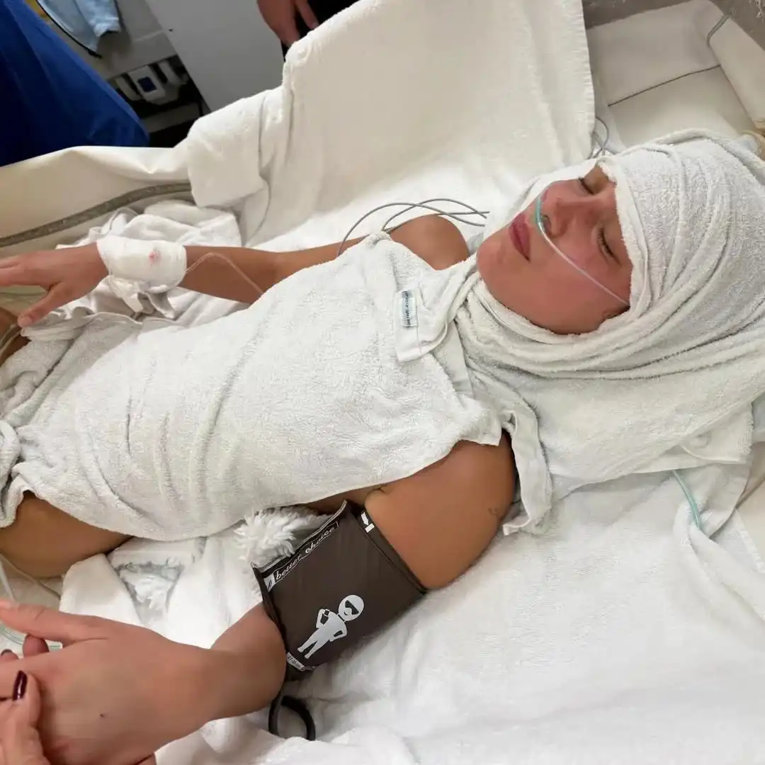 معاناة بيلا حديد مع داء لايم