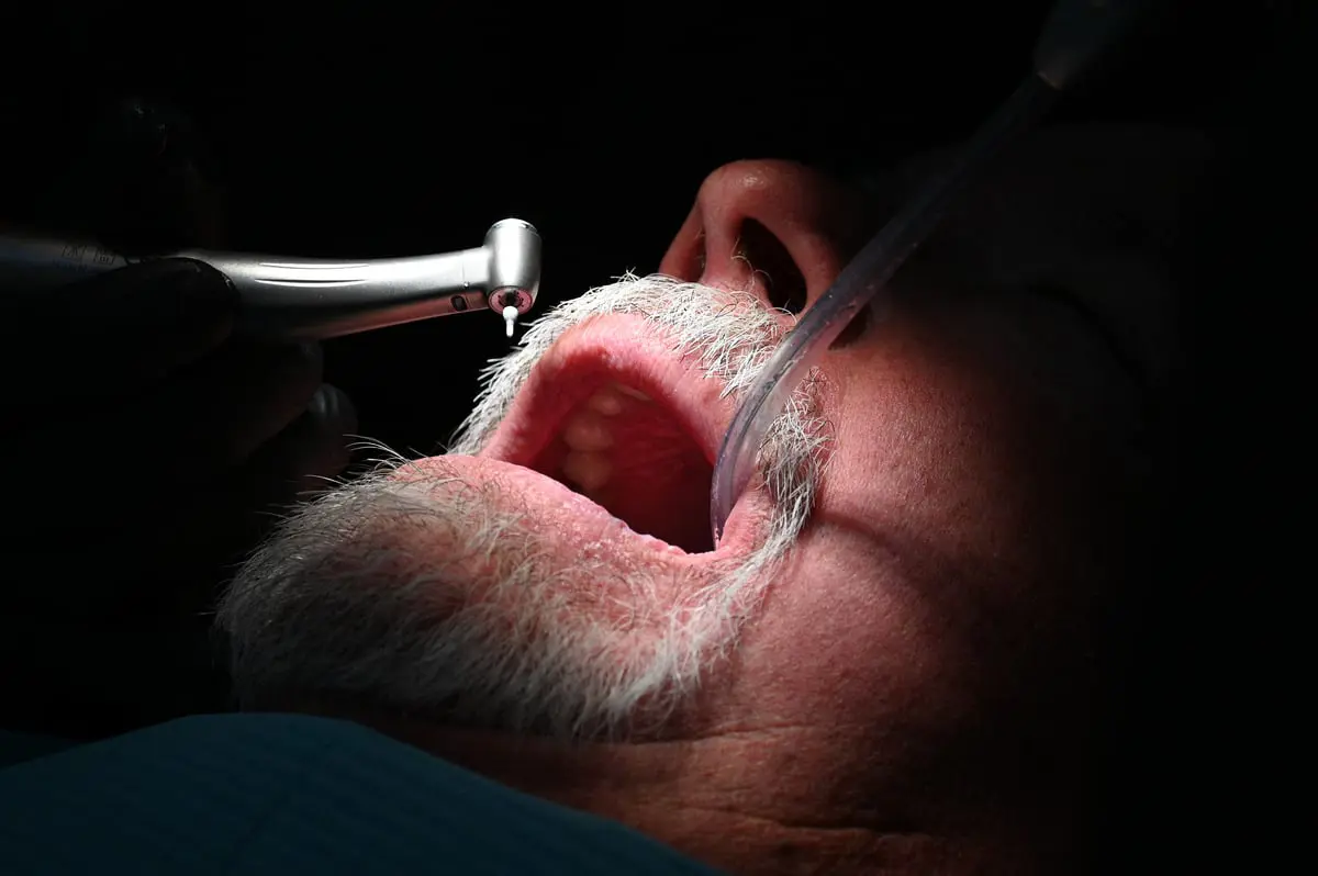 سوء الأوضاع يدفع إيرانيين لقلع الأسنان بدلا من ترميمها