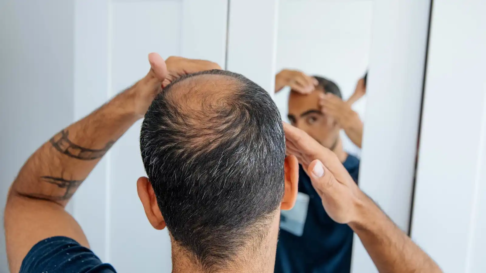 مشروب شائع قد يزيد تساقط الشعر لدى الرجال