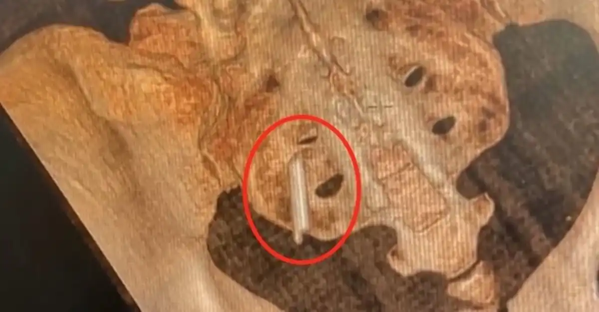 مقياس الحرارة في جسد امرأة صينية