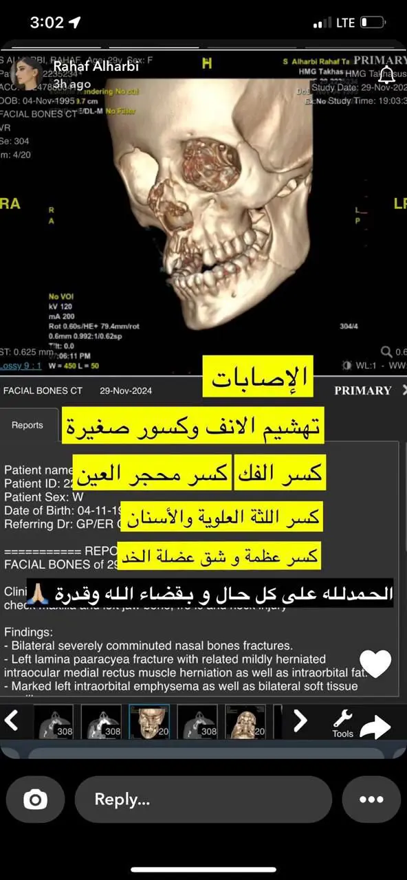 b15a526c-14be-47ea-8be6-43ae13d36d32