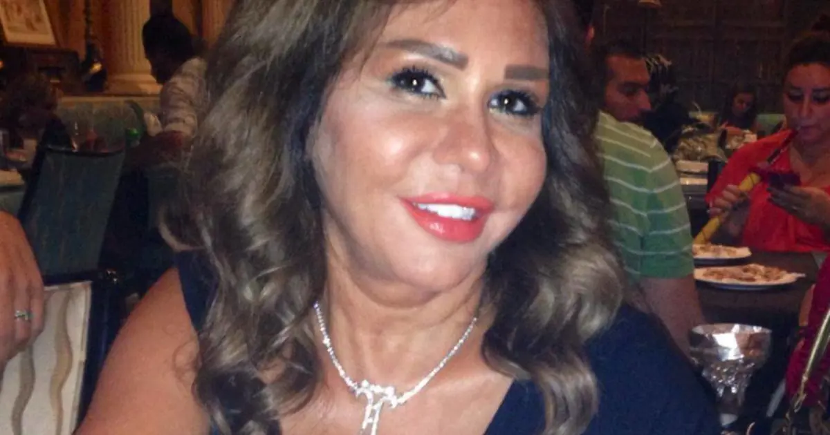 مها المصري بعد التجميل