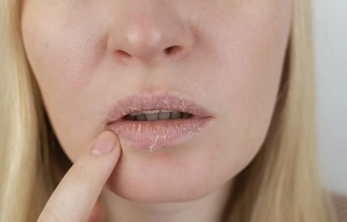 "جفاف الفم" علامة لـ5 أمراض خطيرة