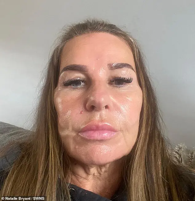 ناتالي براينت بعد التجميل