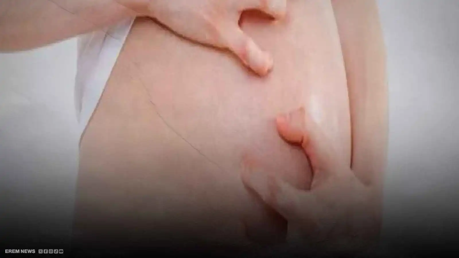 جسدها يرفض الأمومة.. حساسية غريبة تحرم سيدة من الحمل
