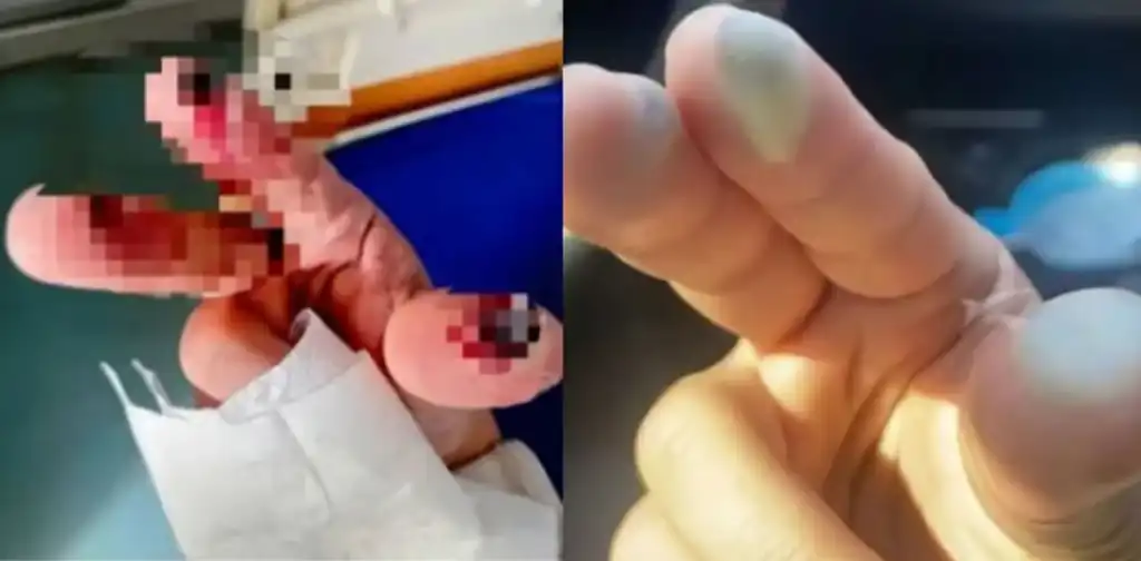 اصابع الضحية