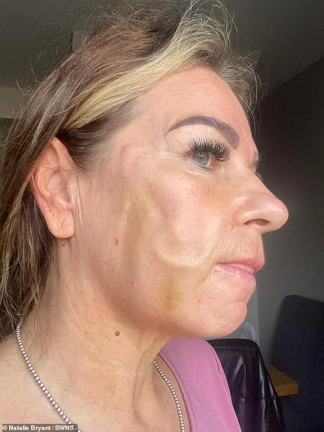 ناتالي براينت بعد التجميل