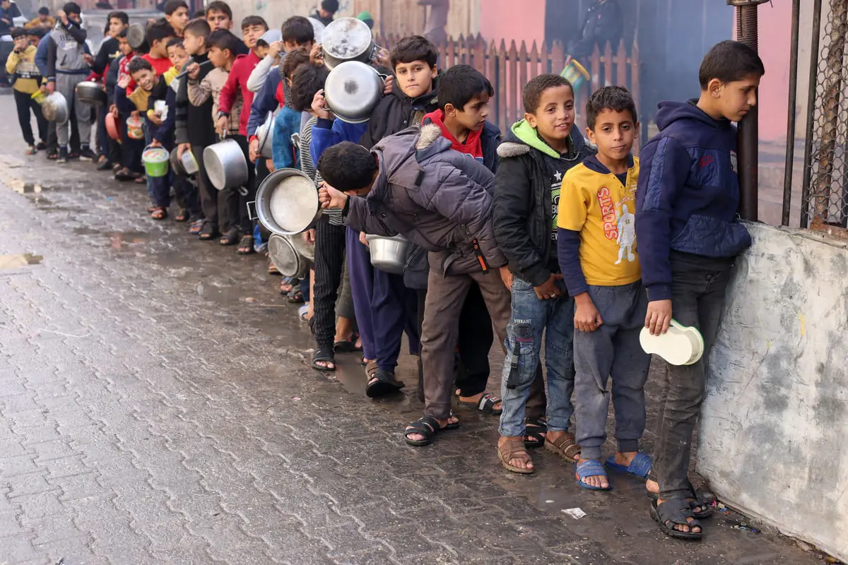  الجوع يتربص بأطفال غزة.. نحول وأمراض