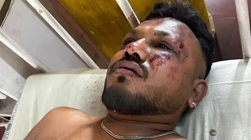 الناجي الوحيد البريطاني فيشواش كومار راميش