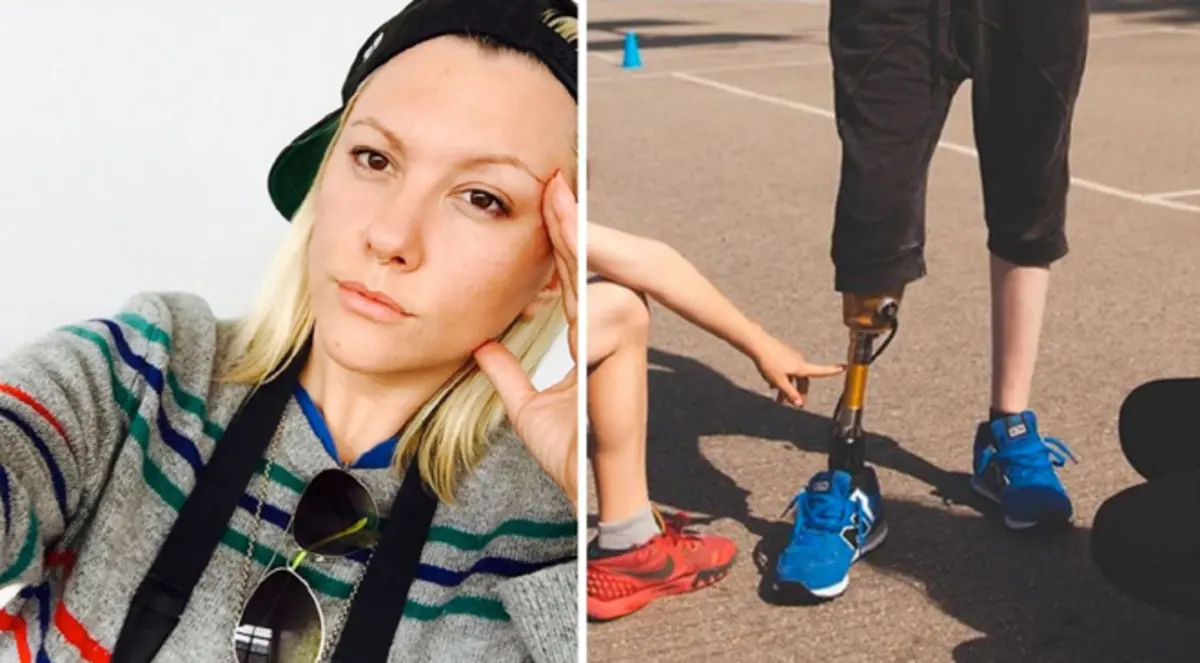 عارضة أزياء تفقد قدمها بسبب فوطة صحية