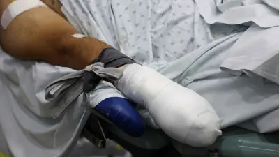أحد المصابين بتفجيرات البيجر في لبنان
