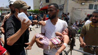طفلة مصابة جراء الحرب في غزة