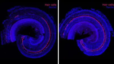 تقنية جديدة لعلاج فقدان السمع