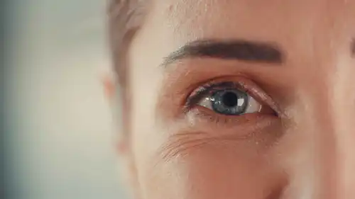 تجاعيد حول العينين